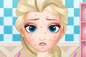 game Squeeze Elsa Pimples